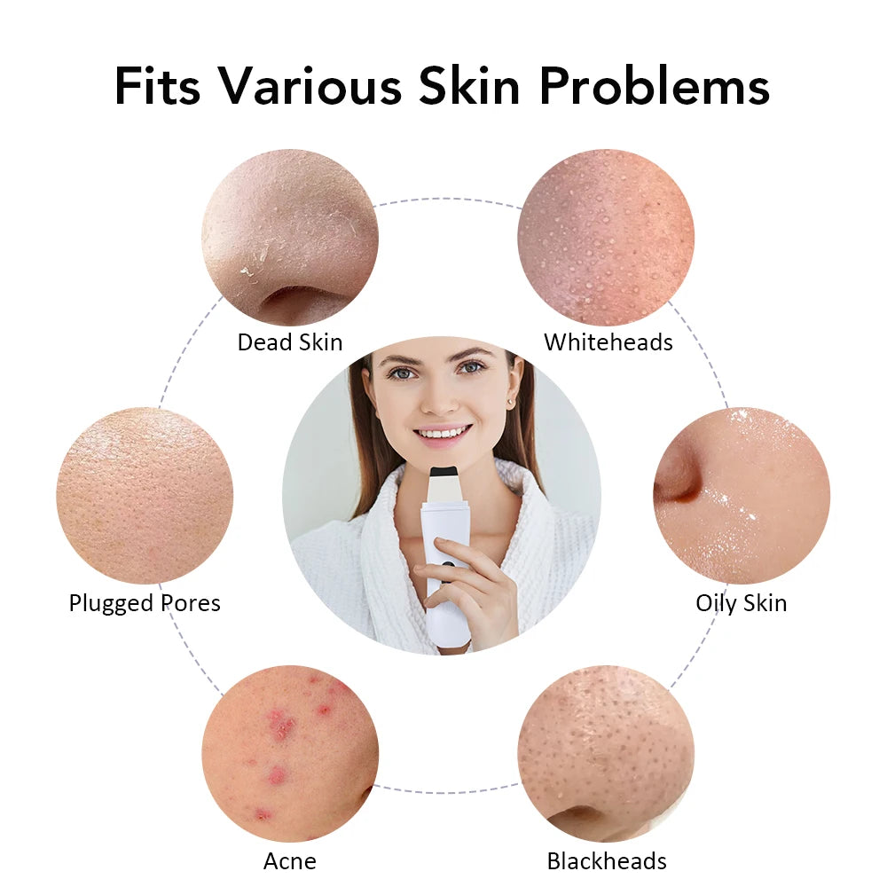 Ultrasonic Skin Scrubber: Ion Facial Cleanser